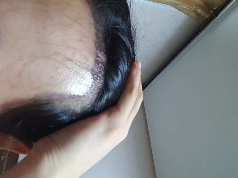 후3.jpg