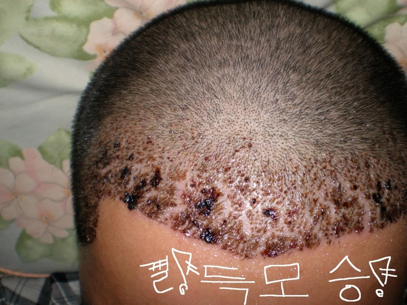 2주경과3.JPG