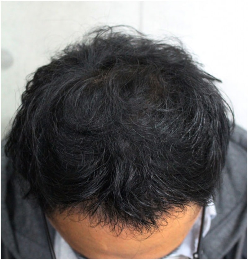 수술후1.jpg