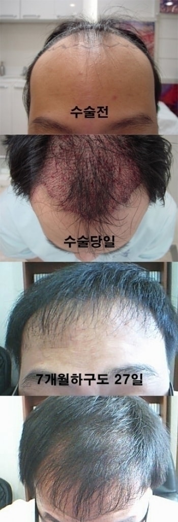 난다이제.jpg