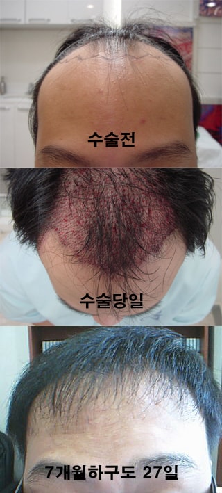 난다이제.jpg