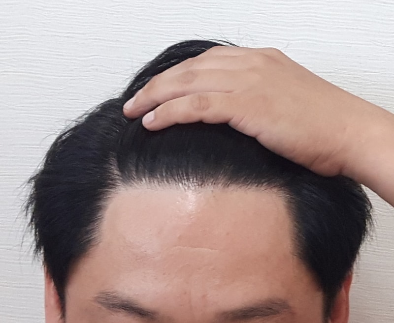 2년10개월 정면.jpg