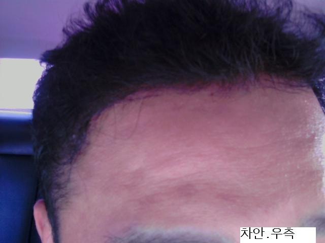 차.우측.JPG