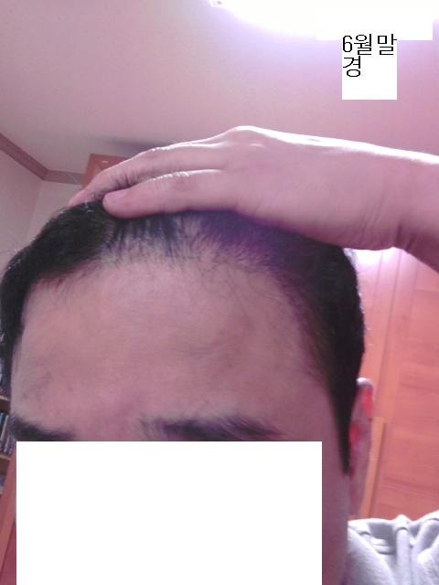 6월말경.JPG
