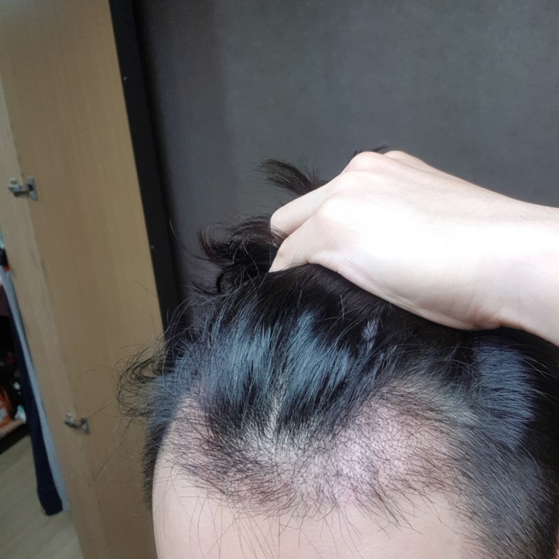 좌측_1달.jpg