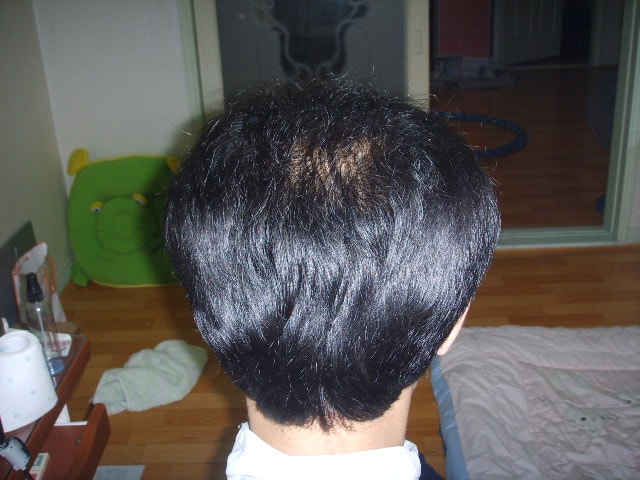 수술하기전1.JPG