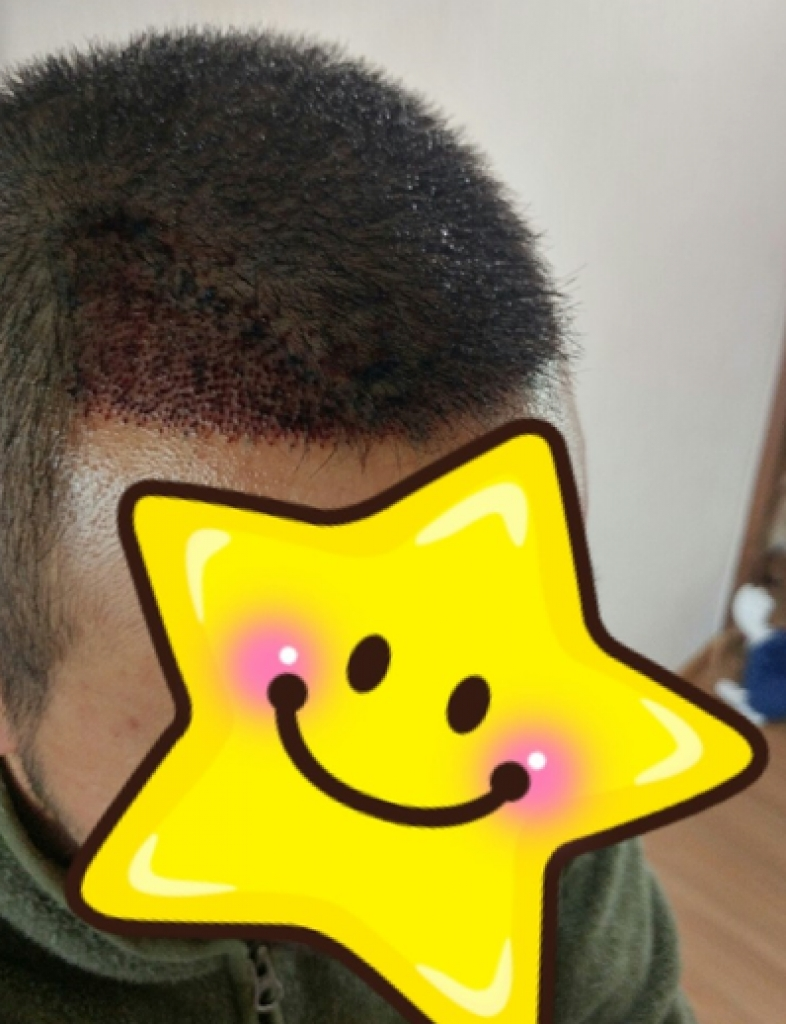 5일차.png