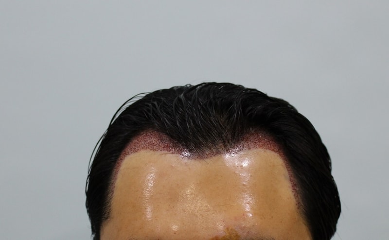 수술후1.jpg