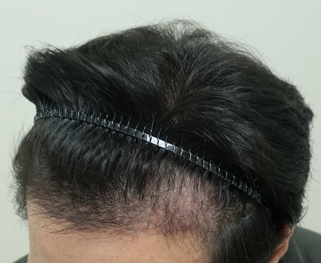 3. 이마 우.jpg