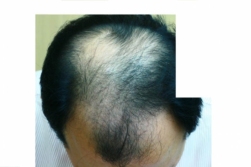 수술전3.jpg