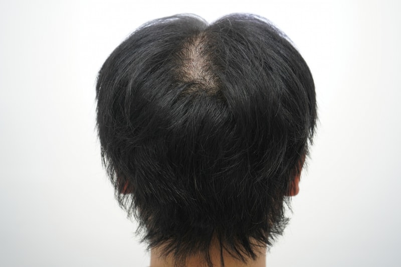 모5.jpg