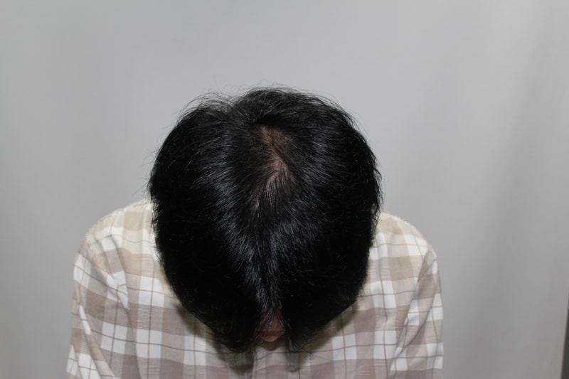 수술전 3.JPG