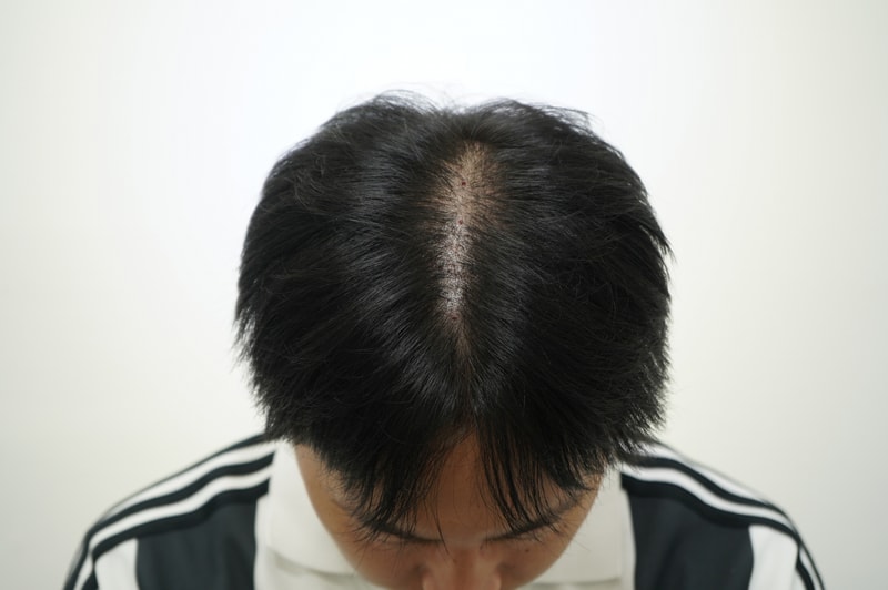 모2.jpg