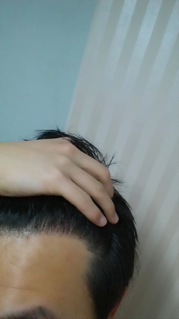 20150322_204431.jpg