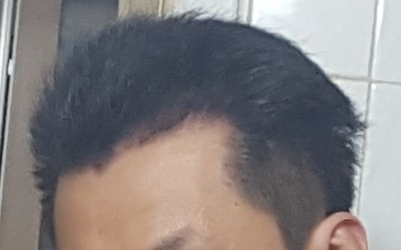 우측.JPG