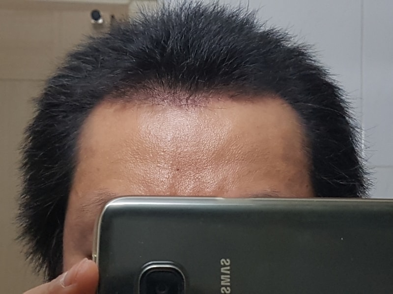 3개월정면.jpg