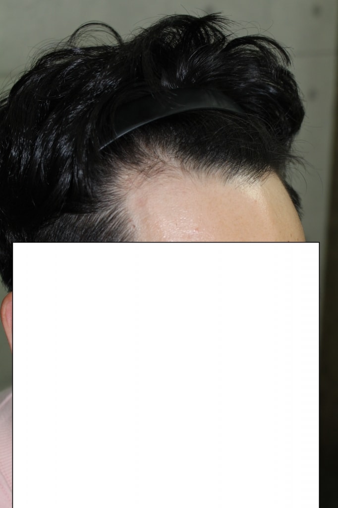 수술전1.jpg