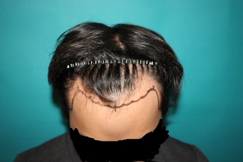 순서1.JPG