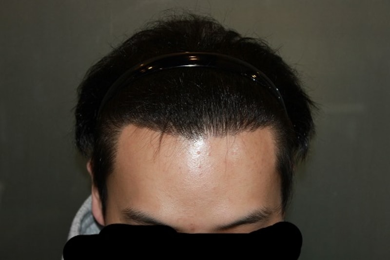 순서5.JPG