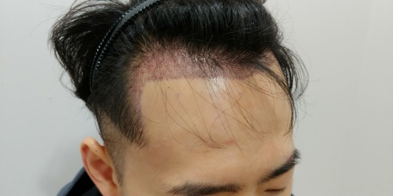 수술후1.jpg
