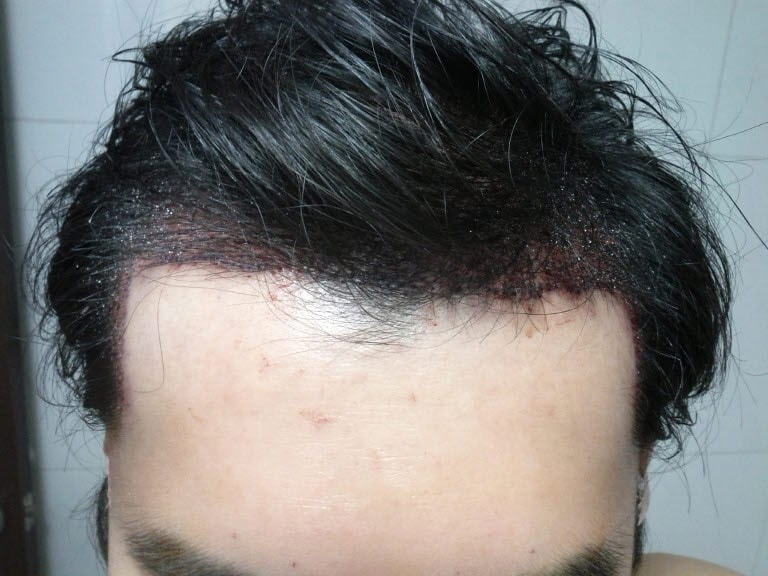 앞머리1202.jpg