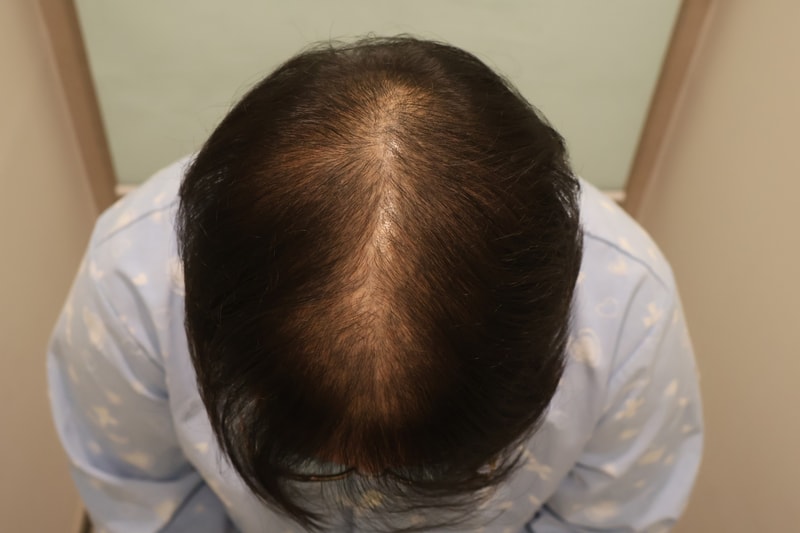 정수리 5000모 30일차 입니다.