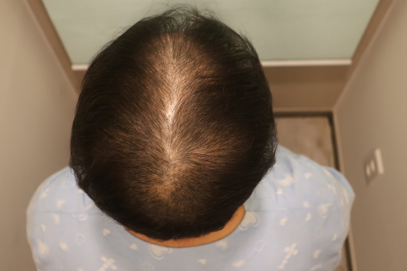 포토후기 이미지