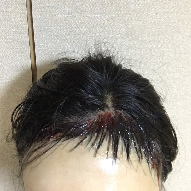 앞당일.jpg
