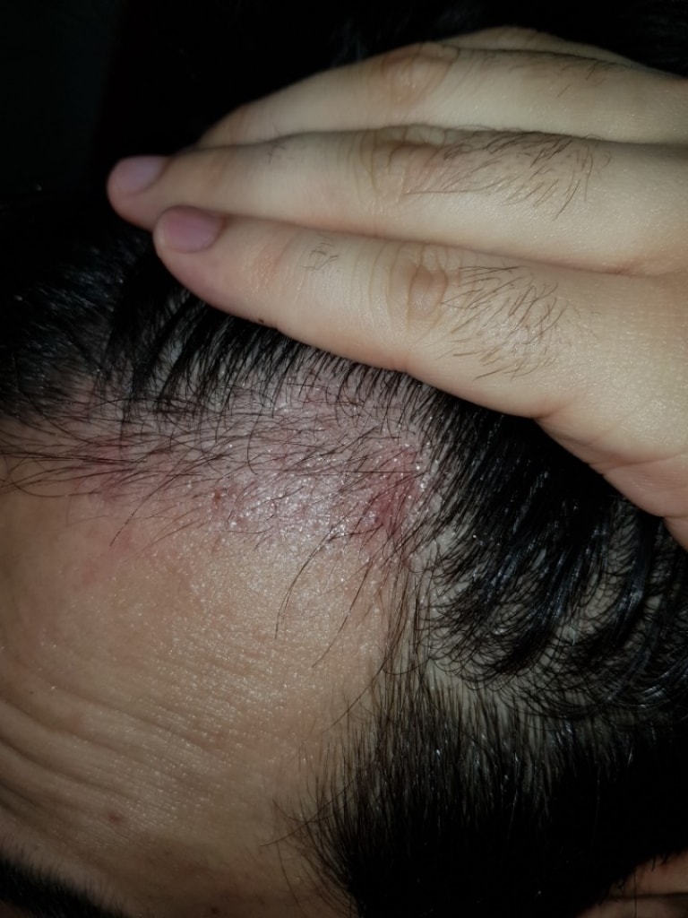 KakaoTalk_20180305_003314612.jpg