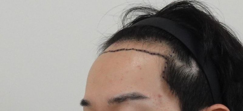 다운로드.jpeg 7l.jpg