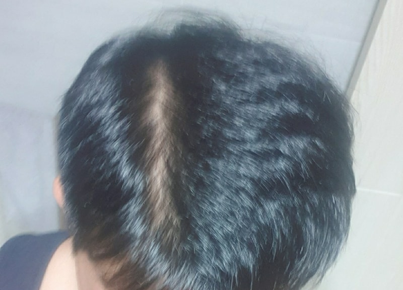 12개월2-1.jpg