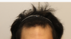 image 1.png