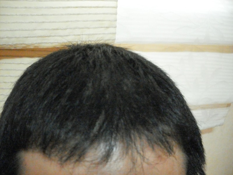 크기변환_정면사진-1.JPG
