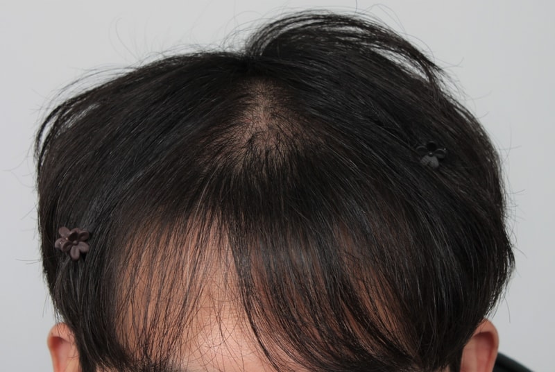 04.암흑기.JPG