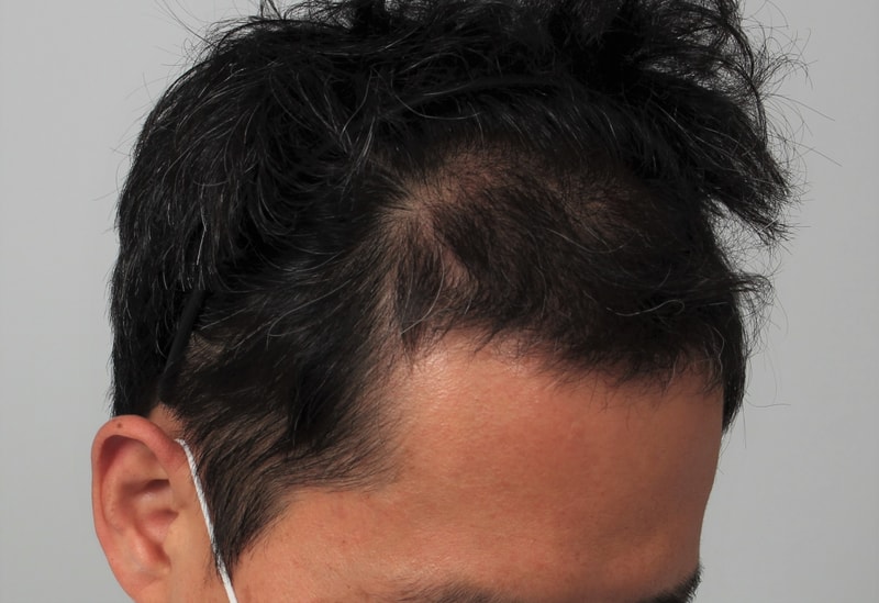 10.수술후.JPG