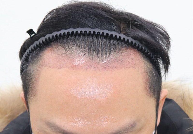 06.암흑기진행중.JPG
