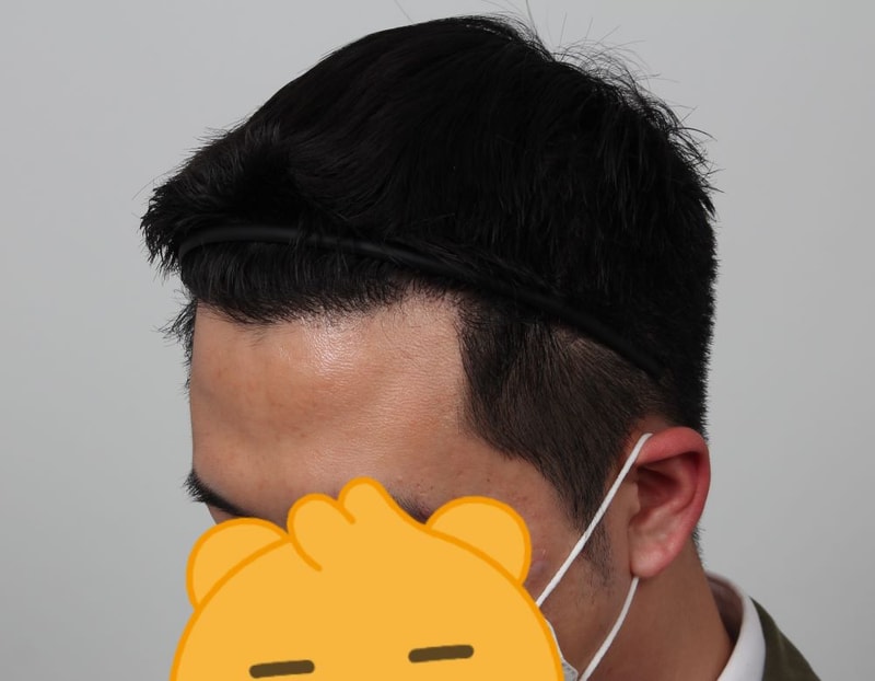 03.1년후.jpg