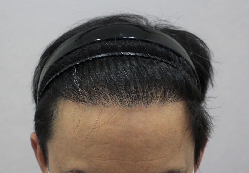 02.현재9개월.JPG