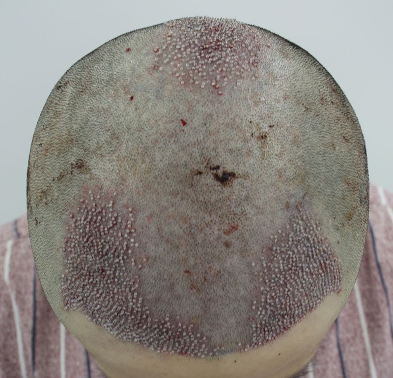 07.수술당일.JPG