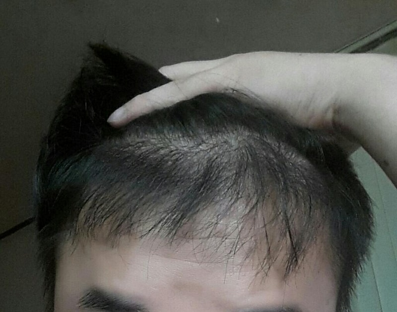 4개월.jpg