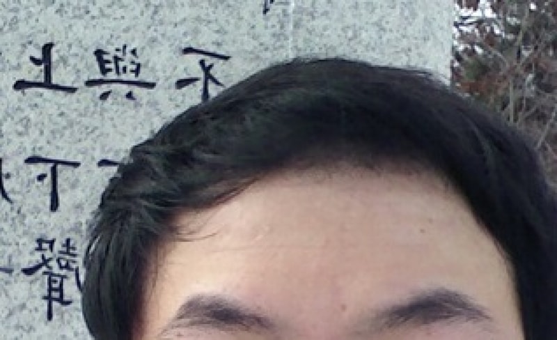 수술3개월후셀카2.jpg