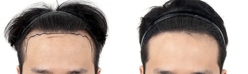 포토후기 이미지