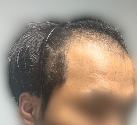 수술전극악.jpg