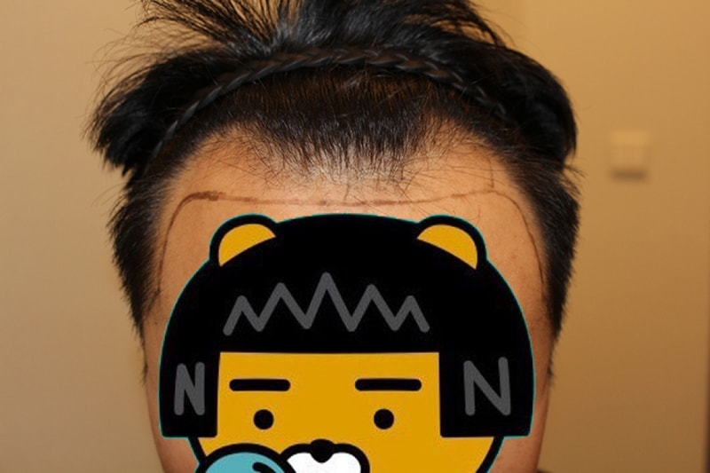 수술전1.JPG