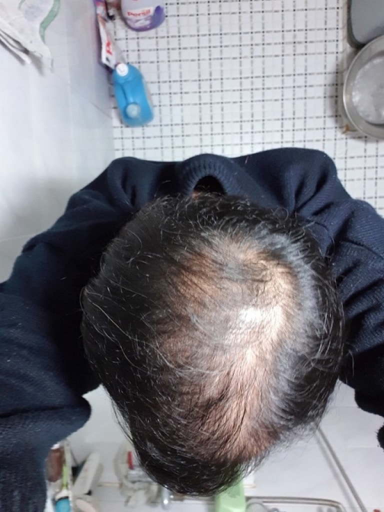 3개월최근.jpg