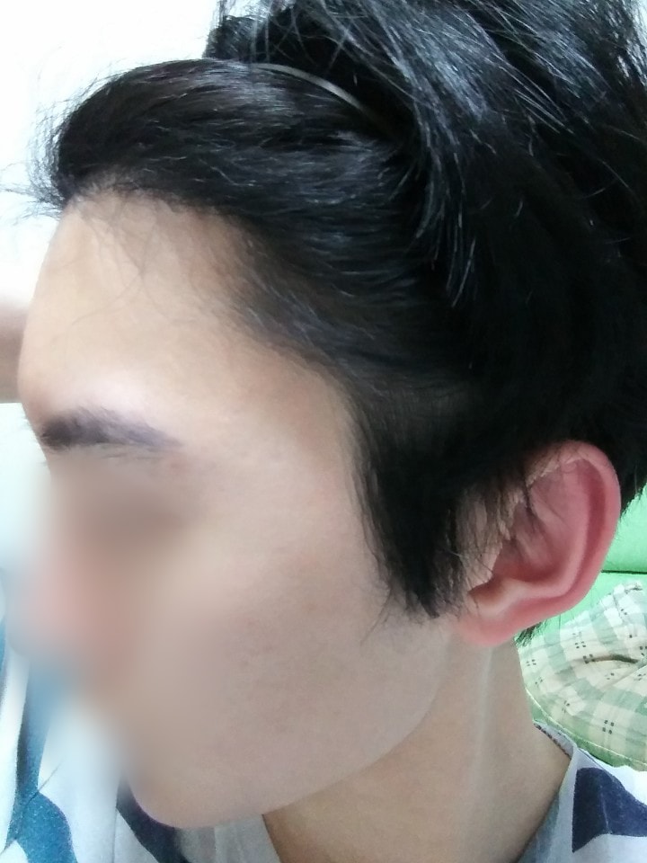 06.김재환_수술7달.jpg