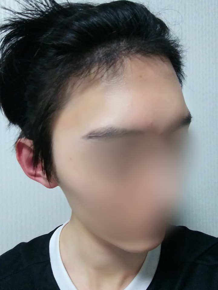 01.수술5달.jpg