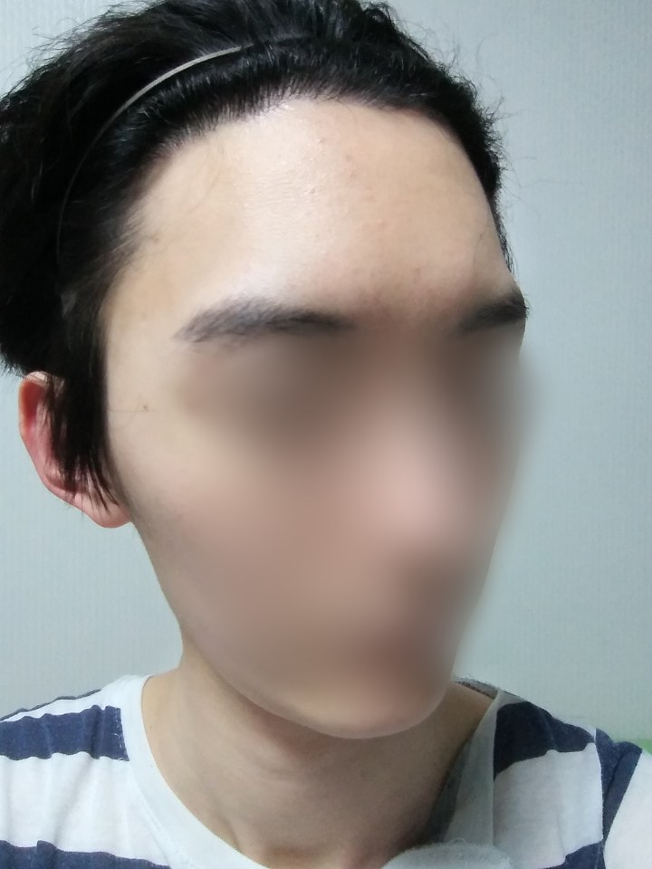 05.김재환_수술7달.jpg