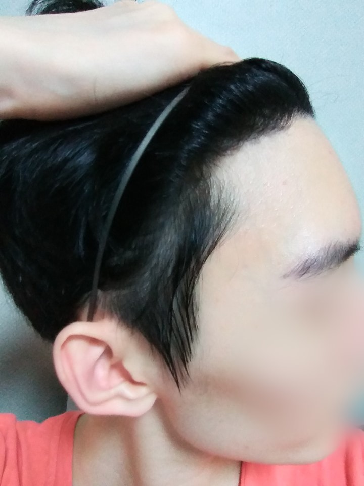 02.김재환_수술10달.jpg
