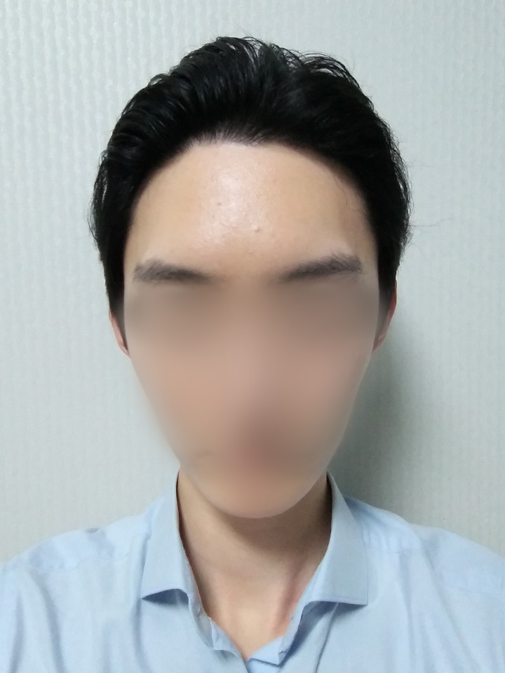 02.김재환_수술9달.jpg